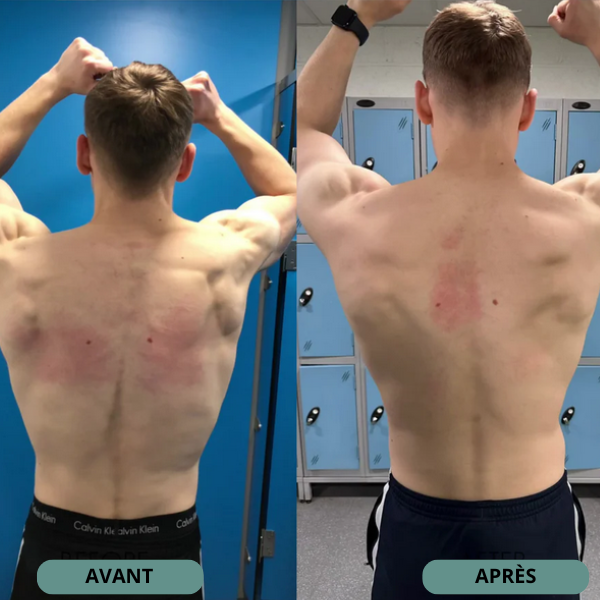 Correcteur de Posture Dos Complet