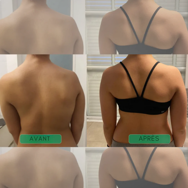 Correcteur de Posture Dos Complet